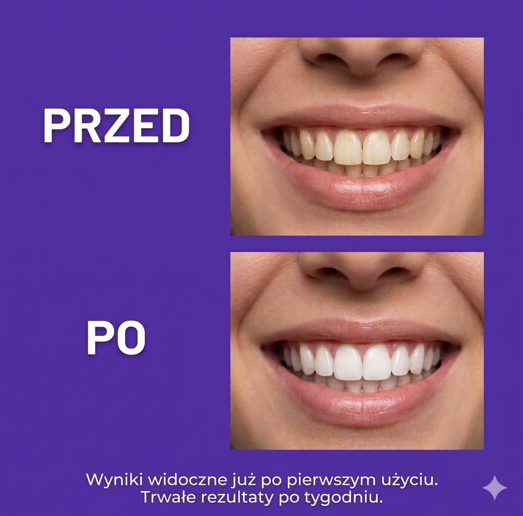 paski wybielające zęby